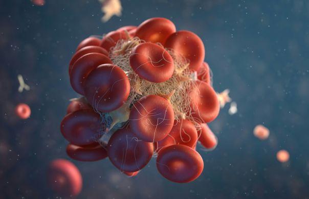 Converting 40% of Predicted Alerts Into Frontline Hodgkin's Lymphoma Treatments